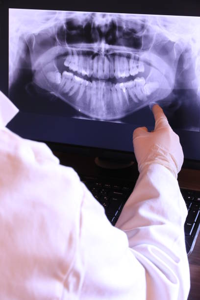Best Emergency Root Canal Treatment in Brookridge, FL